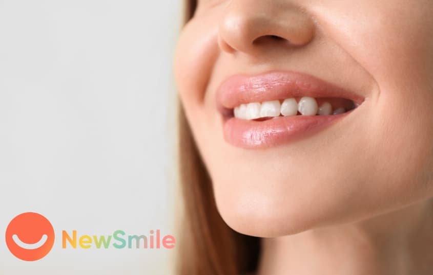 NewSmile: Day & Night Aligners With Remote Treatment