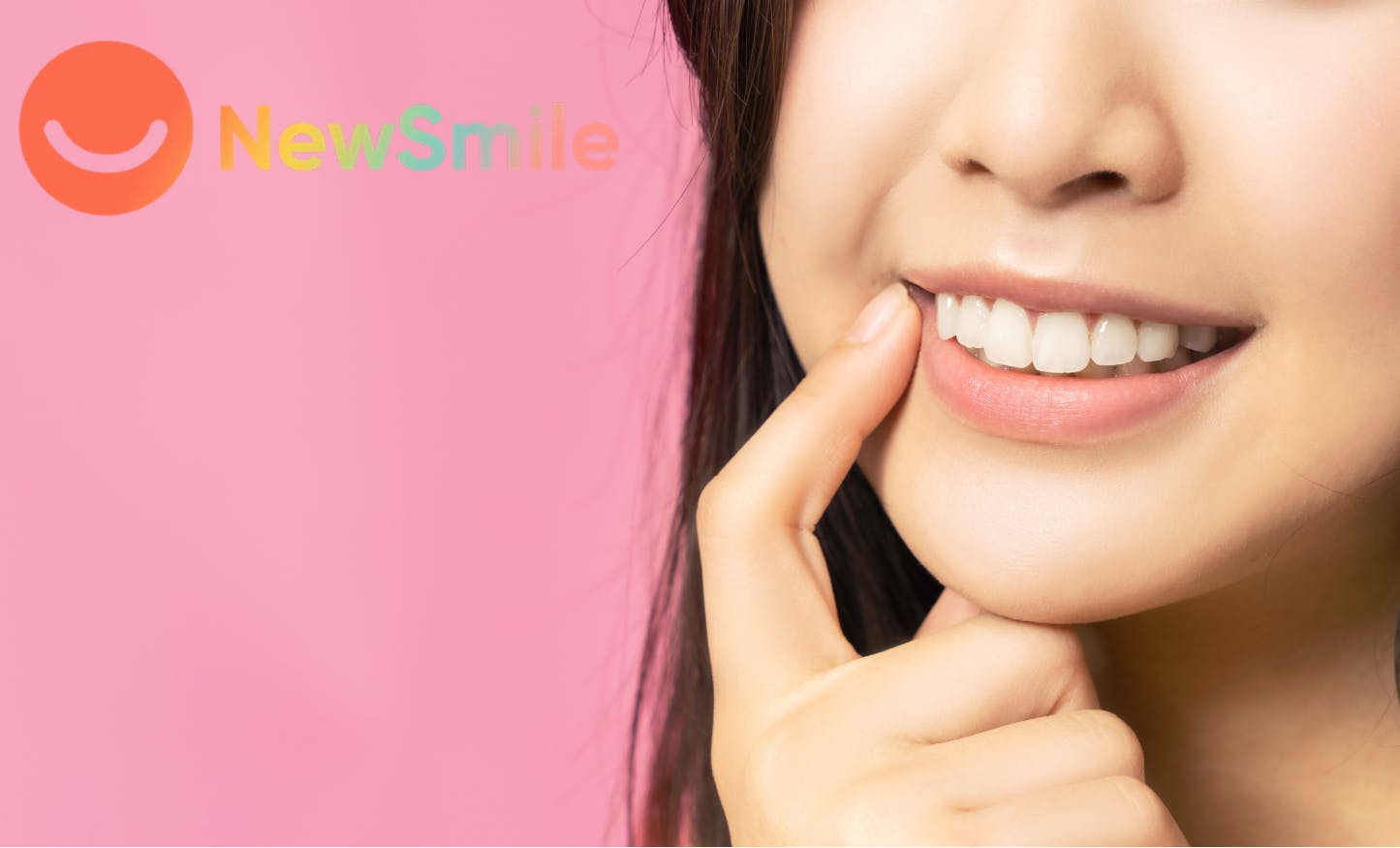 NewSmile: Invisible Aligners Review